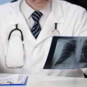 konsultacja pulmonologiczna online